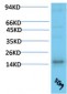 TTR mouse Monoclonal Antibody(5G9)