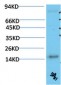 TTR mouse Monoclonal Antibody(5A11)