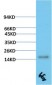 TTR mouse Monoclonal Antibody(6E5)