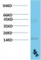 TTR mouse Monoclonal Antibody(9B5)