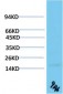 TTR mouse Monoclonal Antibody(9A6)