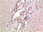 TTR mouse Monoclonal Antibody(9D9)