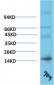 TTR mouse Monoclonal Antibody(9D9)