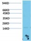 TTR mouse Monoclonal Antibody(10D8)