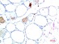 TTR mouse Monoclonal Antibody(10H2)