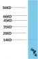 TTR mouse Monoclonal Antibody(10H2)