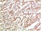 JAK2 mouse Monoclonal Antibody(3F10) 