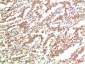 JAK2 mouse Monoclonal Antibody(3F10) 