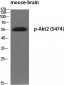 Akt2 (phospho Ser474) Polyclonal Antibody