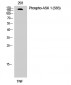 ASK 1 (phospho Ser83) Polyclonal Antibody