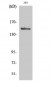 ASK 1 (phospho Ser966) Polyclonal Antibody