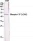 ATF-2 (phospho Ser112) Polyclonal Antibody