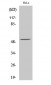 ATF-2 (phospho Ser62) Polyclonal Antibody