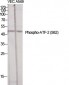 ATF-2 (phospho Ser62) Polyclonal Antibody