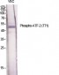ATF-2 (phospho Thr71) Polyclonal Antibody