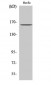 Bcr (phospho Tyr177) Polyclonal Antibody