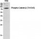 Catenin-β (phospho Thr41/S45) Polyclonal Antibody