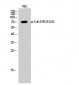 Cdc25B (phospho Ser323) Polyclonal Antibody