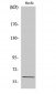 Cdc25C (phospho Ser216) Polyclonal Antibody