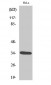 Cdk2 (phospho Thr160) Polyclonal Antibody