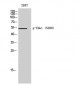 Phospho-Chk1 (S280) Polyclonal Antibody