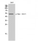 Chk1 (phospho Ser317) Polyclonal Antibody