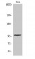 Chk2 (phospho Thr68) Polyclonal Antibody