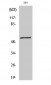 c-Myc (phospho Thr58) Polyclonal Antibody
