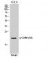 Cofilin (phospho Ser3) Polyclonal Antibody