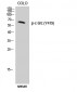 c-Src (phospho Tyr419) Polyclonal Antibody