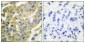 Cytokeratin 8 (phospho Ser73) Polyclonal Antibody