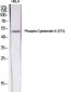 Cytokeratin 8 (phospho Ser73) Polyclonal Antibody