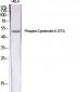 Cytokeratin 8 (phospho Ser73) Polyclonal Antibody