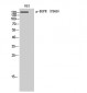 EGFR (phospho Tyr869) Polyclonal Antibody