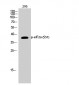 eIF2α (phospho Ser51) Polyclonal Antibody