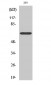 ERα (phospho Ser104) Polyclonal Antibody