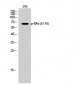 ERα (phospho Ser118) Polyclonal Antibody