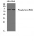 Ezrin (phospho Thr566) Polyclonal Antibody