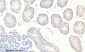 FoxO3A (phospho Ser253) Polyclonal Antibody