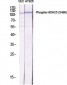 HDAC5 (phospho Ser498) Polyclonal Antibody