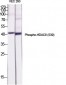 HDAC8 (phospho Ser39) Polyclonal Antibody