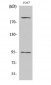 IGF-IR (phospho Tyr1165/Y1166) Polyclonal Antibody