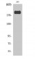 IRS-1 (phospho Ser307) Polyclonal Antibody