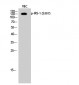 IRS-1 (phospho Ser307) Polyclonal Antibody