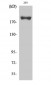 IRS-1 (phospho Ser639) Polyclonal Antibody