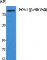 IRS-1 (phospho Ser794) Polyclonal Antibody