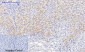 IκB-α (phospho Ser32/S36) Polyclonal Antibody