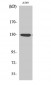 JAK1 (phospho Tyr1022) Polyclonal Antibody