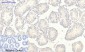 JAK2 (phospho Tyr1007) Polyclonal Antibody