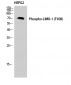 LIMK-1 (phospho Thr508) Polyclonal Antibody
